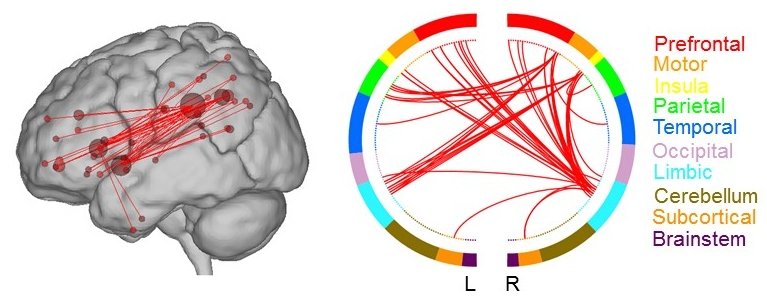 creative brain areas